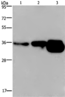 Anti-CUEDC2 antibody