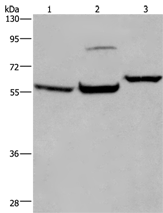 Anti-ESR1 antibody