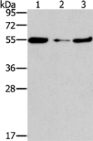 Anti-FGFR1OP antibody