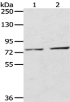 Anti-ECE2 antibody