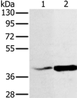 Anti-NDUFA10 antibody