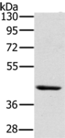Anti-HSD3B7 antibody