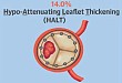 术后 30 天零死亡？外科手术低危患者行 TAVR 治疗