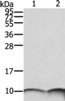 Anti-S100A6 antibody