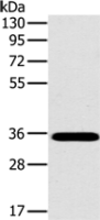 Anti-OTUB1 antibody