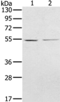 Anti-NMT2 antibody