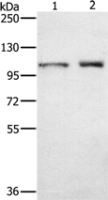 Anti-ODF2 antibody