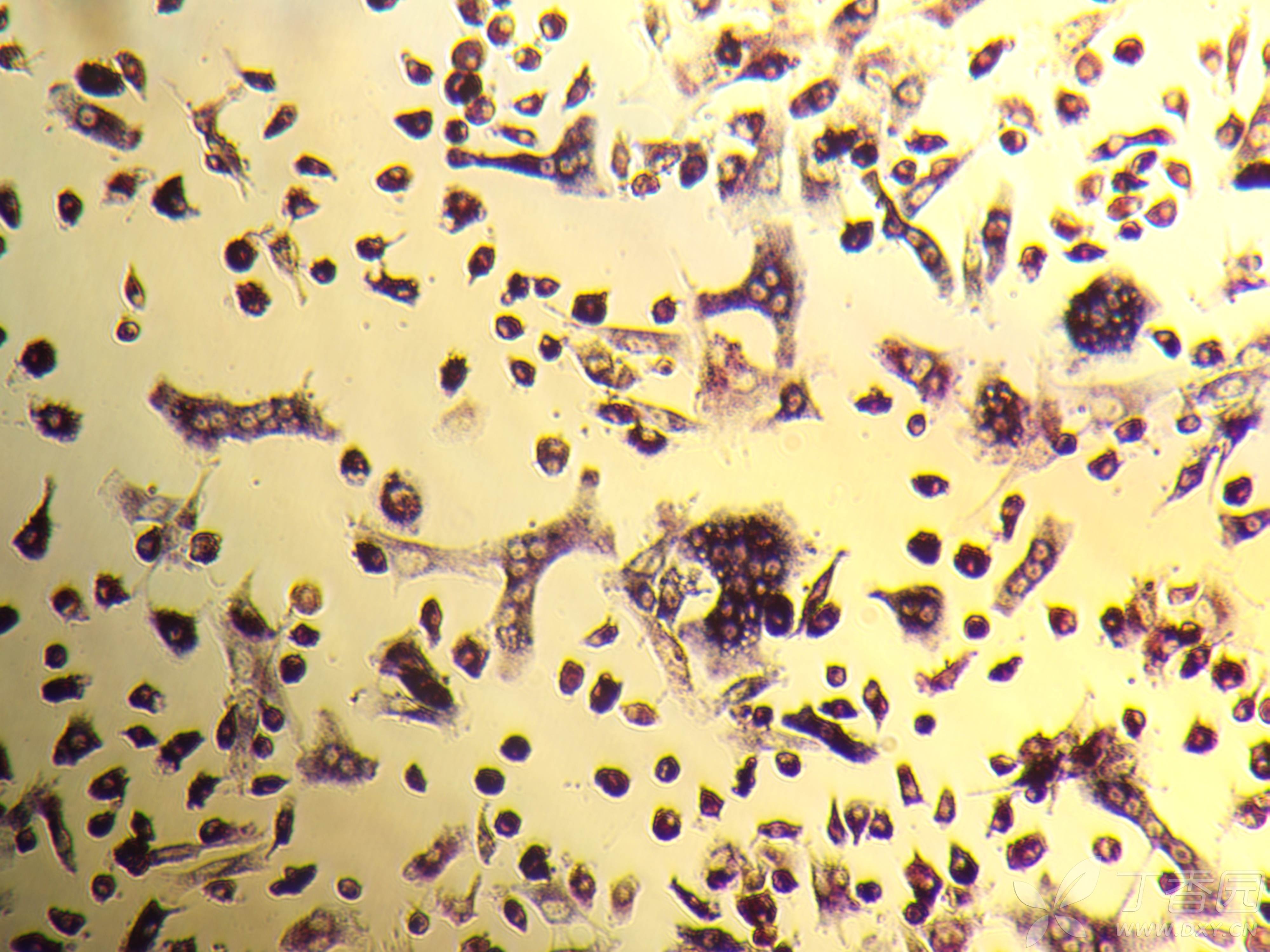 小鼠bmms诱导破骨细胞 - 丁香园论坛