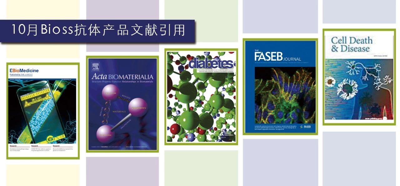 文献调研｜2018年10月Bioss产品高分文献引用精选