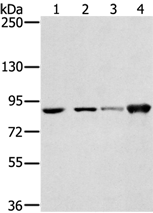 Anti-RNF214 antibody