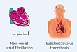 经股动脉途径 TAVR 术后大中风发生率低于外科换瓣