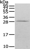 Anti-RAB20 antibody