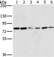 Anti-NOX5 antibody