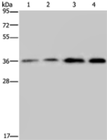Anti-OCIAD1 antibody
