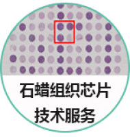 石蜡组织芯片定制服务