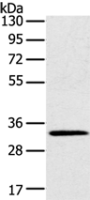 Anti-STK16 antibody