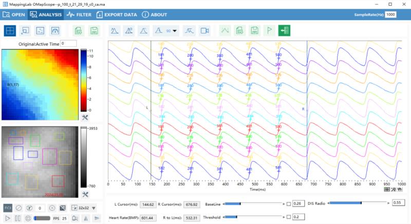 心脏荧光标测系统-心肌细胞钙瞬变