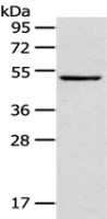 Anti-TRIM49 antibody
