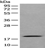 Anti-ZNHIT1 antibody