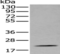 Anti-ZFAND5 antibody