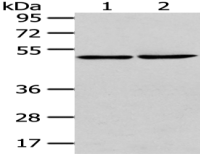 Anti-TBC1D22A antibody