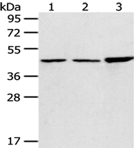 Anti-PLIN3 antibody