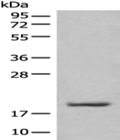 Anti-UBE2E3 antibody