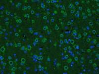 FITC标记的胶质细胞源性神经营养因子抗体