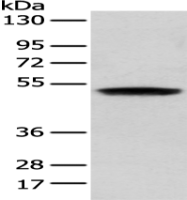Anti-ZNF621 antibody
