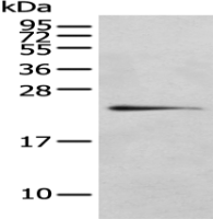 Anti-RILPL2 antibody