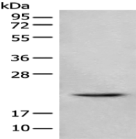 Anti-TSEN15 antibody