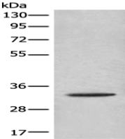 Anti-CACNG3 antibody