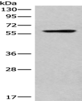 Anti-CORO2B antibody