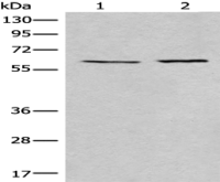 Anti-USP14 antibody