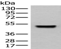 Anti-SEPT10 antibody