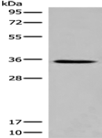 Anti-ITM2B antibody
