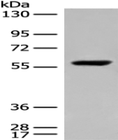 Anti-DALRD3 antibody