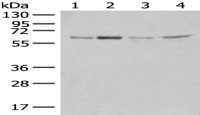 Anti-ZGPAT antibody