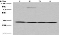 Anti-MRPL1 antibody