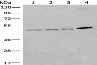 Anti-SPOCK3 antibody