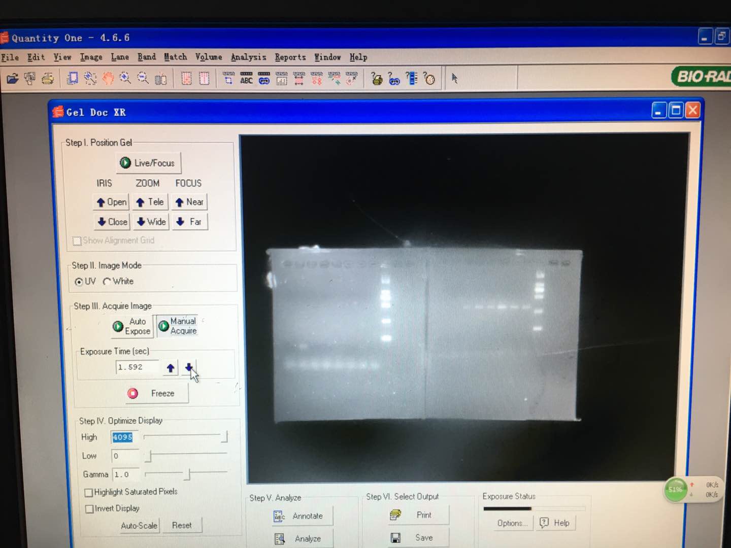 关于凝胶电泳结果图分析 蛋白质免疫印迹(western blot,wb 经验