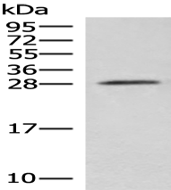 Anti-NIPSNAP3A antibody
