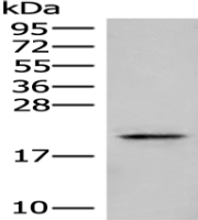 Anti-ARL2BP antibody