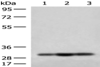 Anti-MRPS18B antibody
