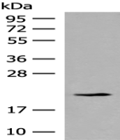 Anti-RPL23A antibody