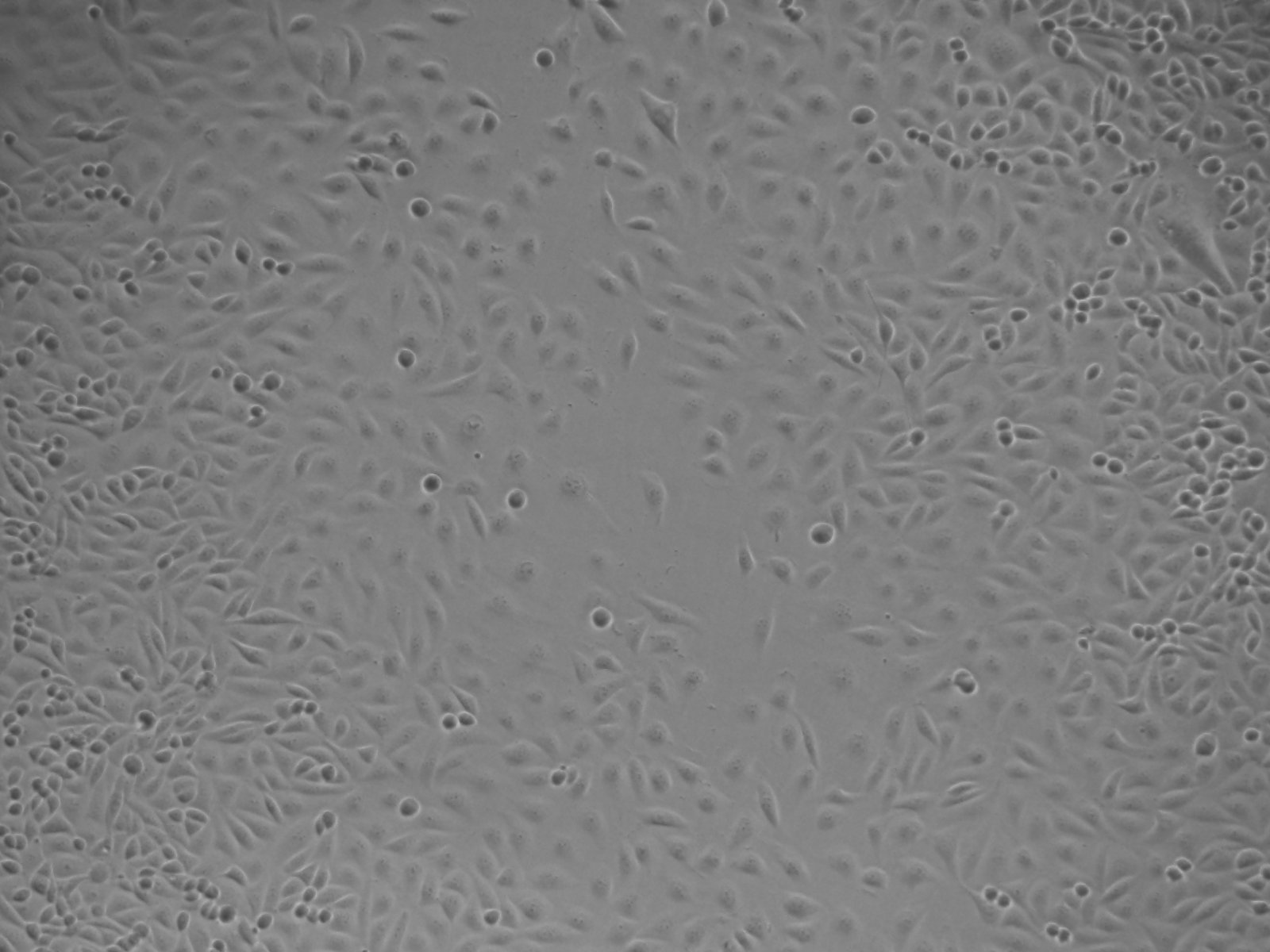 人脊髓星形胶质细胞