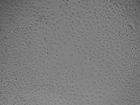 人脊髓星形胶质细胞