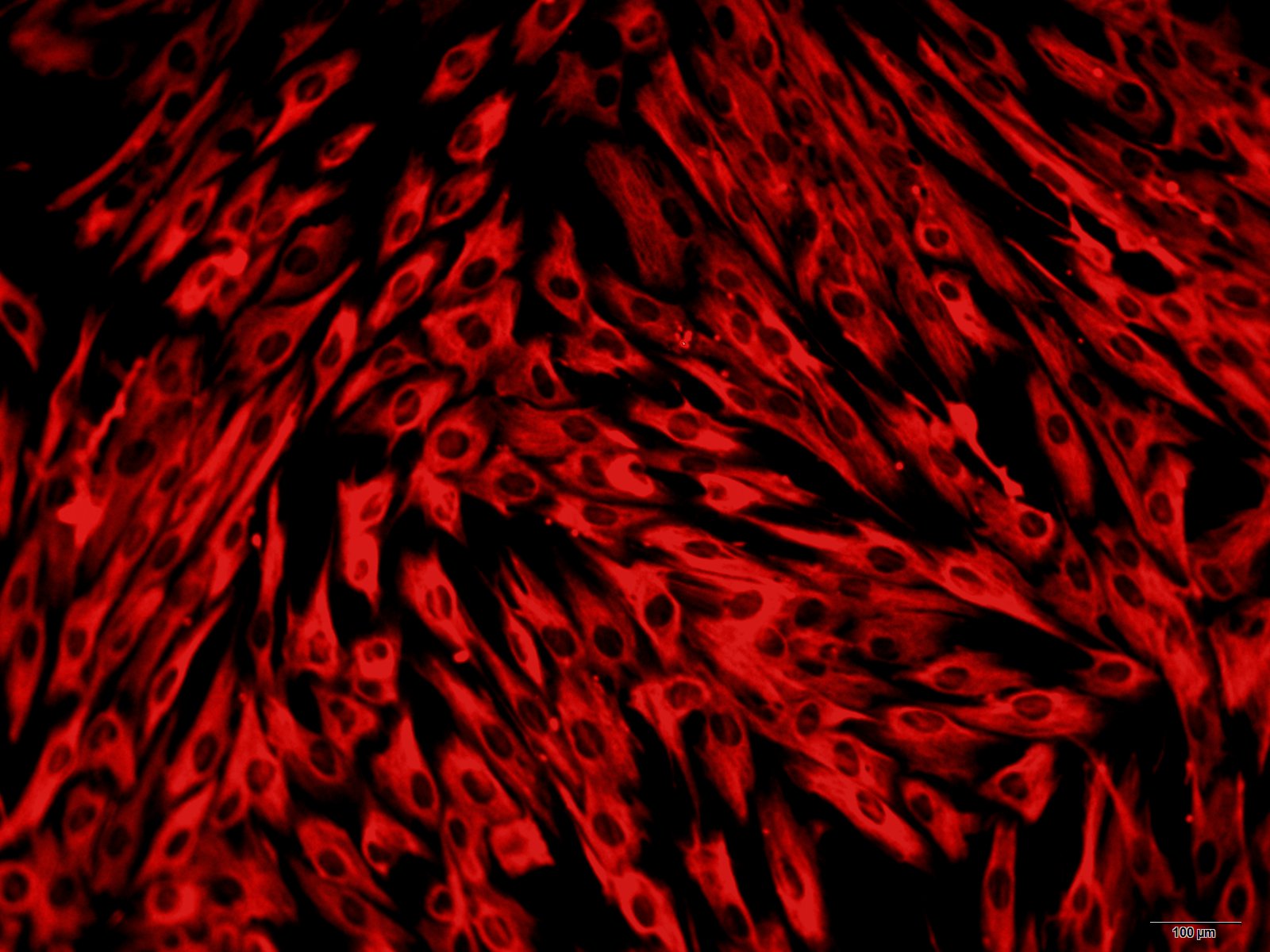 人骨髓内皮祖细胞