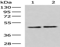 Anti-ACTL6B antibody