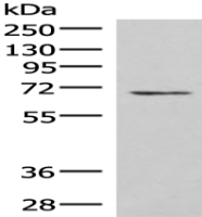Anti-C19orf57 antibody